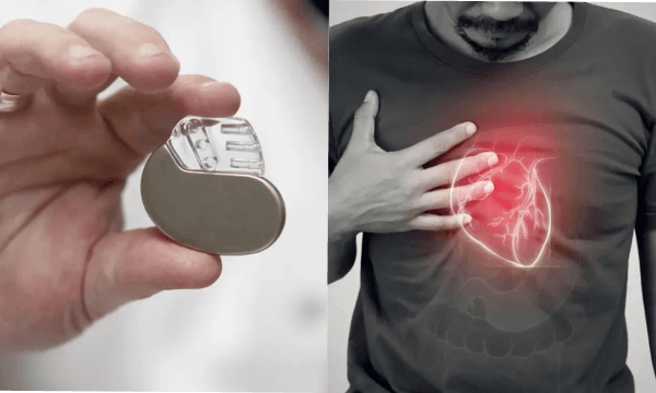 এই প্রথম মানুষের শরীরে মেশিনের মাধ্যমে হৃদস্পন্দন