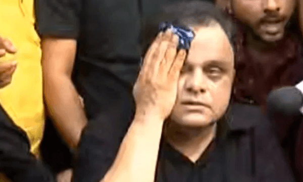 Bratya Basu | আহত শিক্ষামন্ত্রী ব্রাত্য বসু, ভাঙা হল গাড়ির কাচ!