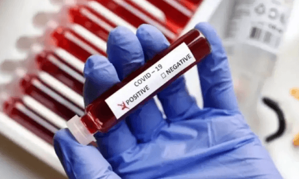 COVID 19 | লাফিয়ে বাড়ছে করোনা?